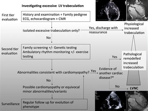 noncompaction cardiomyopathy guidelines